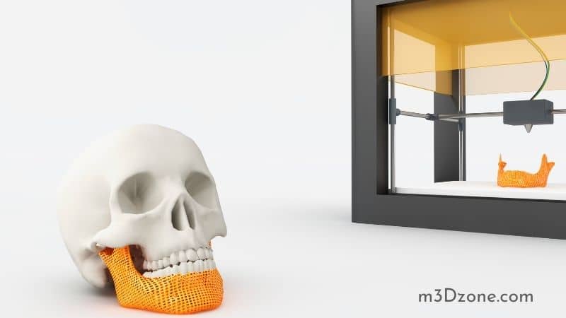 3D Printed Jaw